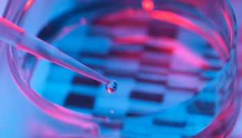 Medicinsko savjetovalište online - Aktualni pristup odraslim osobama sa SMA tip II i III